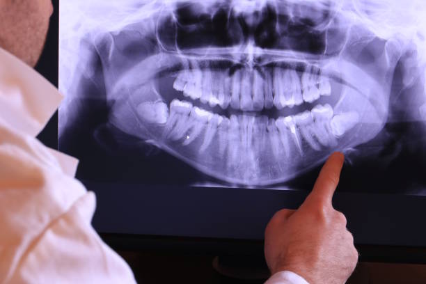 Best Weekend Emergency Dentist in Lemon Grove, CA