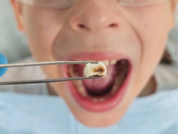 Best Emergency Dental Services for Seniors in Lemon Grove, CA